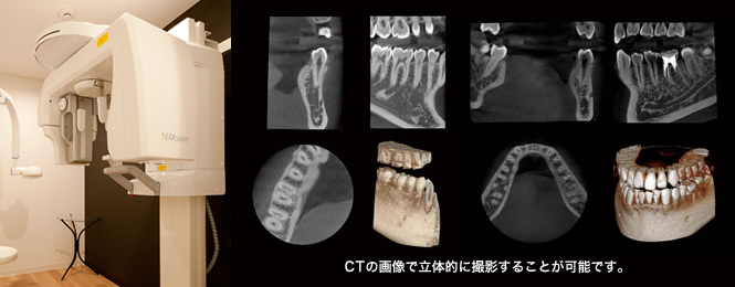 口腔内写真、模型などを使い手術のシミュレーション