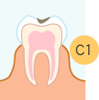 C1イメージ