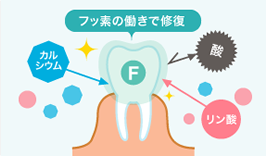 フッ素の働きで修復