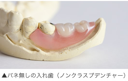 バネ無しの入れ歯(ノンクラスプデンチャー)