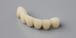 オールセラミックイメージ